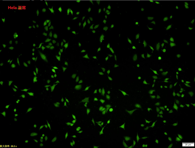 活性氧检测试剂盒