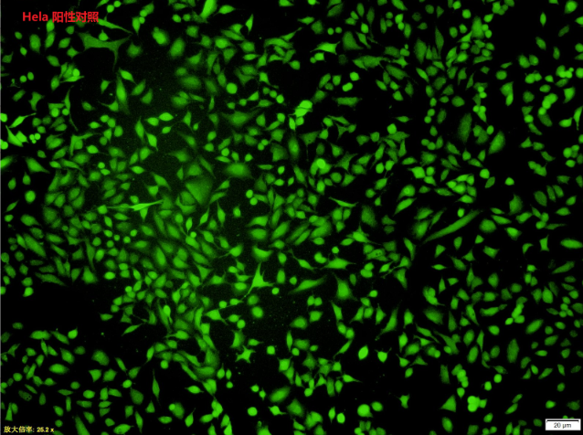 活性氧检测试剂盒
